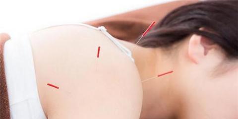 中醫(yī)針灸有什么作用 針灸的六個優(yōu)點你知么