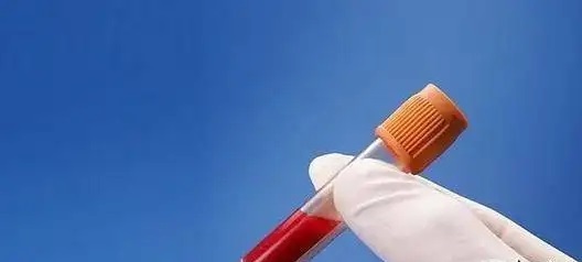 查血脂前有哪些禁忌？四類人調脂藥不能停