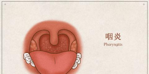 藥膳養(yǎng)出好喉嚨，中醫(yī)教你慢性咽炎食療方