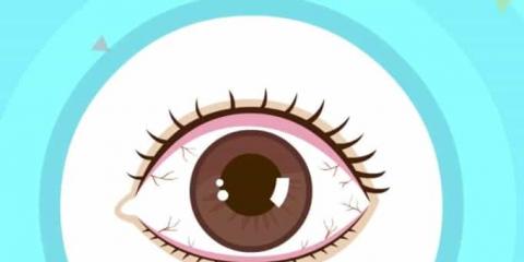 中醫(yī)治干眼：方法多樣，標(biāo)本兼治