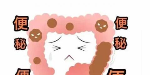 便秘總不好，您找對原因了嗎？
