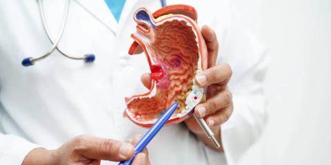 推薦4個(gè)小方幫您緩解胃部不適！